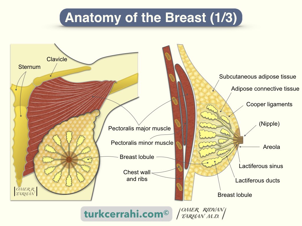 Insufficient glandular tissue (breast hypoplasia)